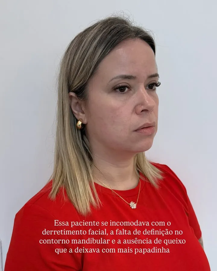 Antes 5