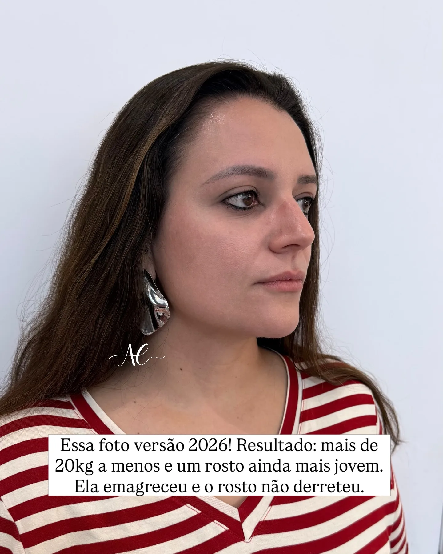 Depois 4