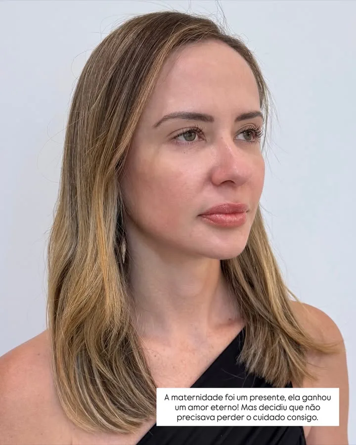 Depois 6